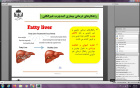 برگزاری کارگاه تحت عنوان ورزش و بیماری کبد چرب